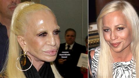 donatella versace schönheits op|donatella versace beauty.